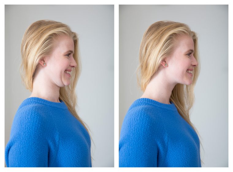 A before and after shot of a woman demonstrating the peach technique to stop a double chin in photos